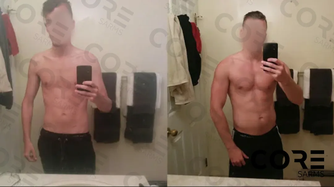 Muscle Bundle
